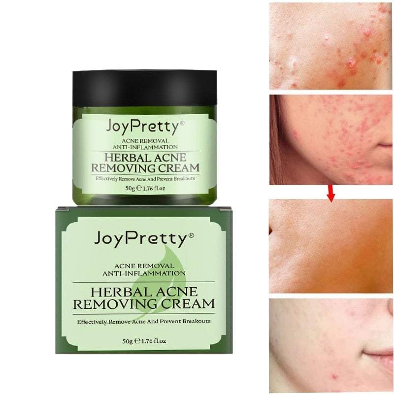 ClearPores Herbal Acne Cream