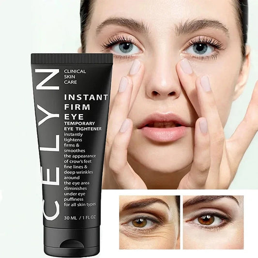 Celyn Botox-Free Beauty Cream